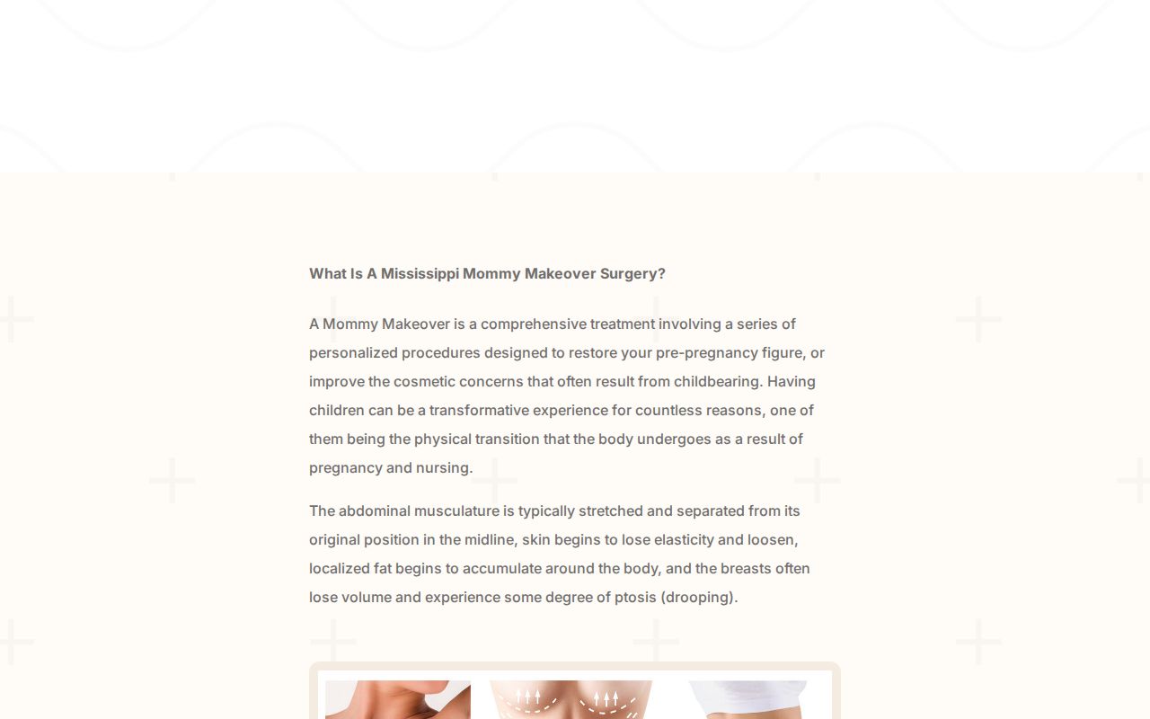 Mommy Makeover Mississippi